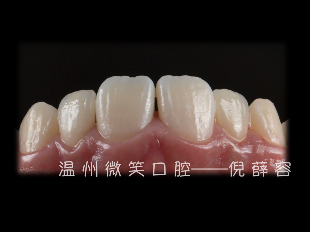 网站病例照片2.005.jpeg